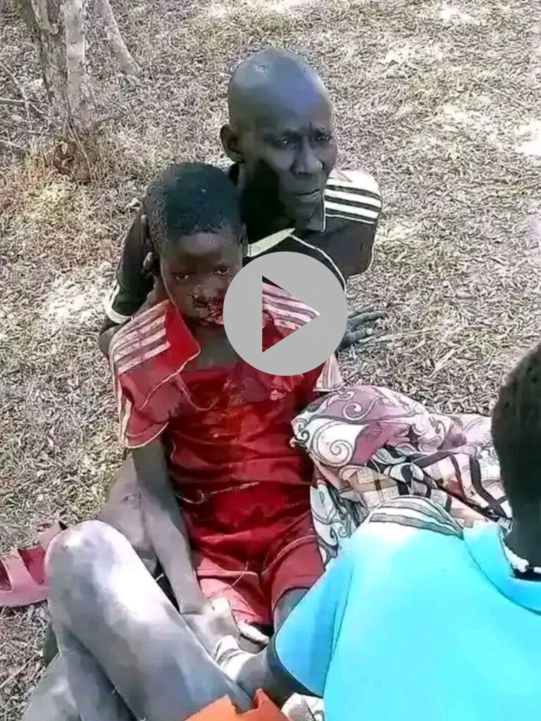 Vídeo mostra menino que foi atac…ver mais